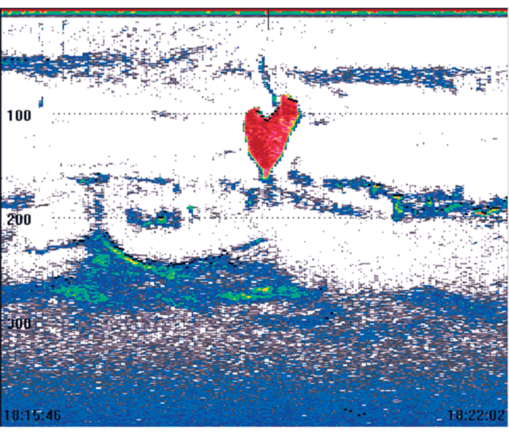 Figure 3.1 ‘Heart attack’.