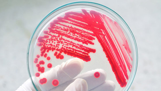Mikrobiologi laboratorietest.